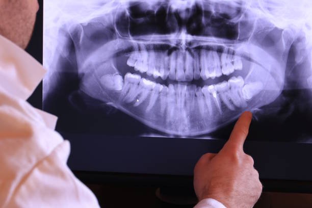 Best Emergency Treatment for Oral Infections in Knoxville, IA