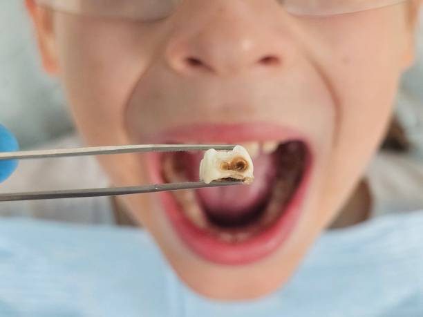 Best After-Hours Dental Care in Knoxville, IA